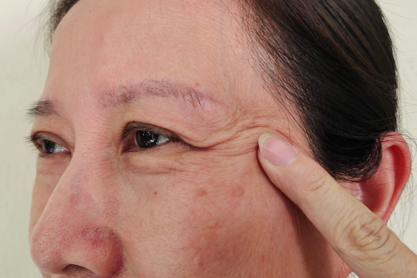 Reduces Wrinkles & Fine Lines